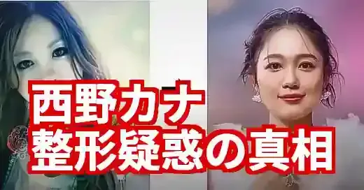 【比較画像】西野カナの整形疑惑を徹底検証！復帰で顔変わった？ (関連: 芸能, 音楽, 西野カナ, 整形, 活動再開)